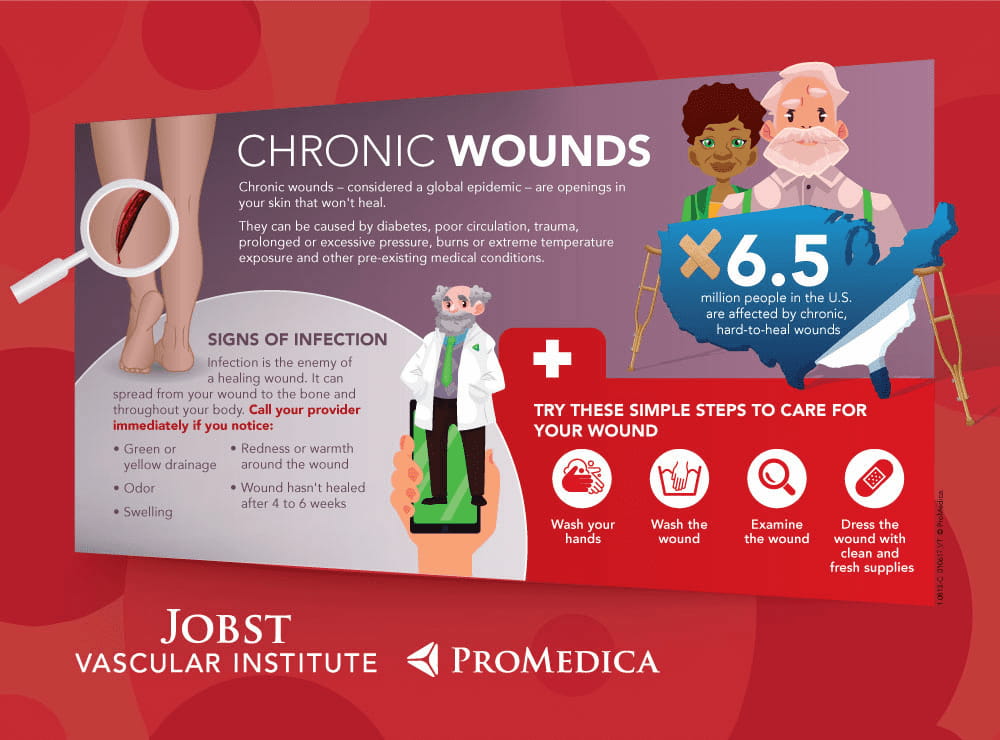 An illustration with chronic wound care statistics