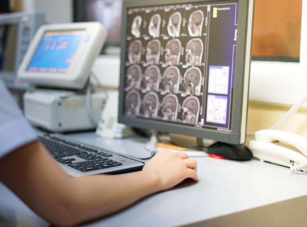 a radiology technician examines an MRI readout